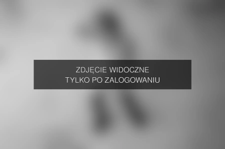 Zdjęcie dostępne po zalogowaniu – Mariusz Łężniak